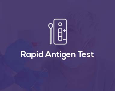 Rapid-Antigen-Test