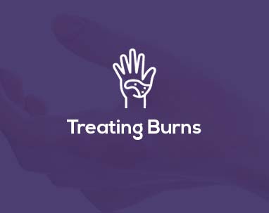 Treating-Burns-